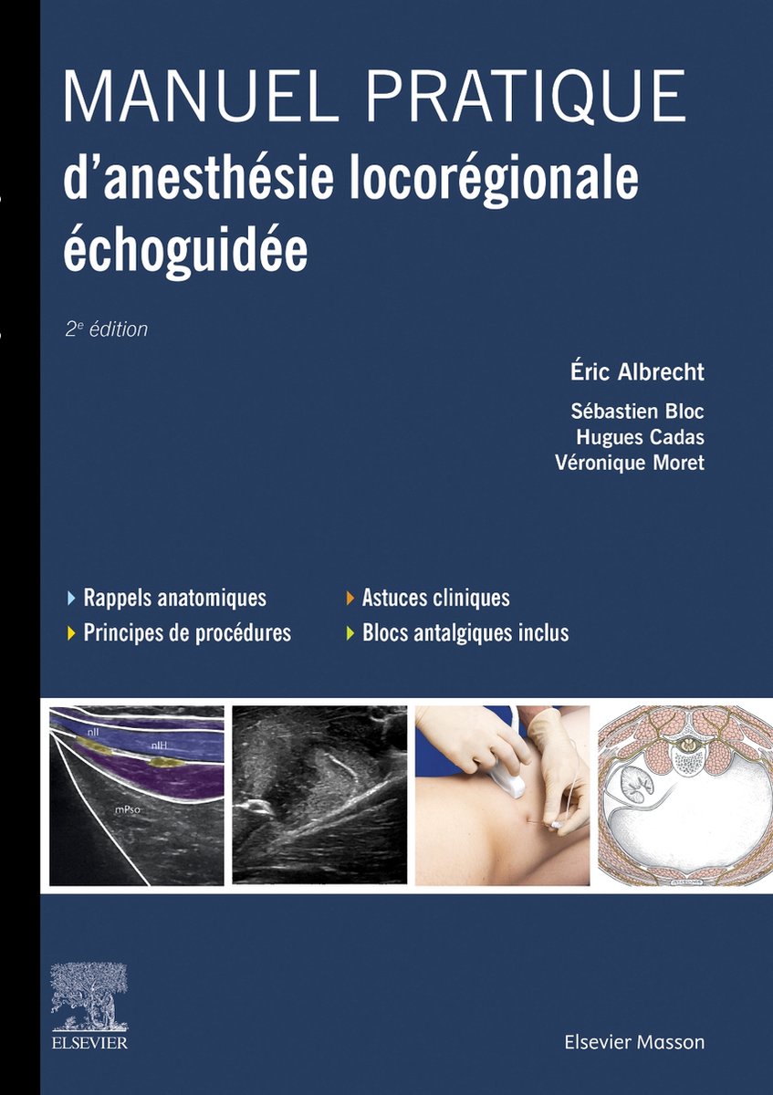 Manuel pratique d'anesthésie locorégionale échoguidée