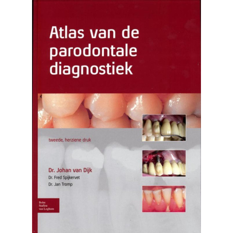 Atlas van de parodontale diagnostiek (Hardback)