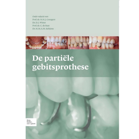 De partiele gebitsprothese (Hardback)