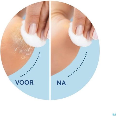 Scholl Velvet Smooth - Elektrische Eeltvijl - Blauw - 1 Stuk