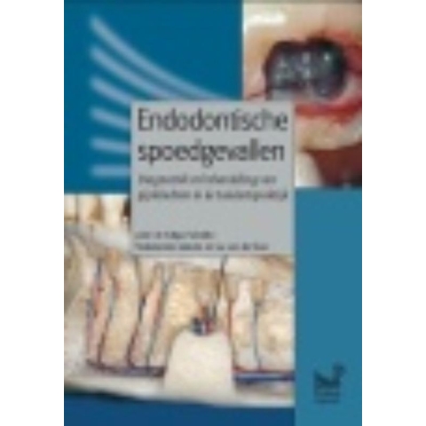 Endodontische spoedgevallen (Hardback)