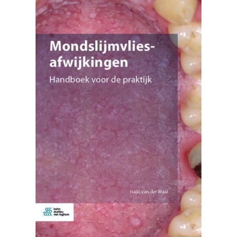 Mondslijmvliesafwijkingen (Paperback)