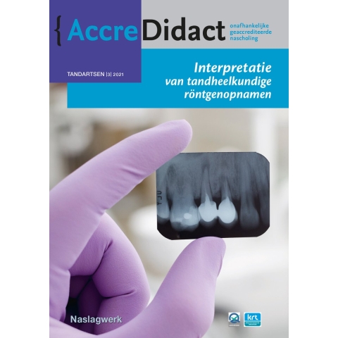 Interpretatie van tandheelkundige röntgenopnamen (Paperback)