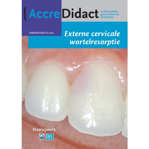 Externe cervicale wortelresorptie (Paperback)