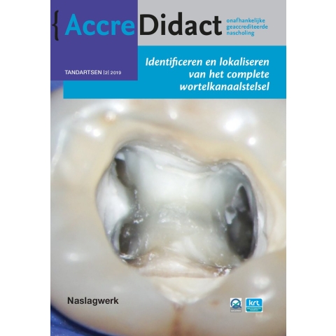 Identificeren en lokaliseren van het complete wortelkanaalstelsel (Paperback)