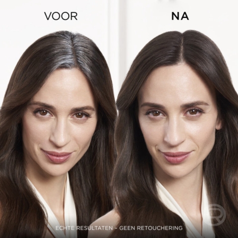 3x L'Oréal Magic Retouch Uitgroeispray Donkerbruin 75 ml
