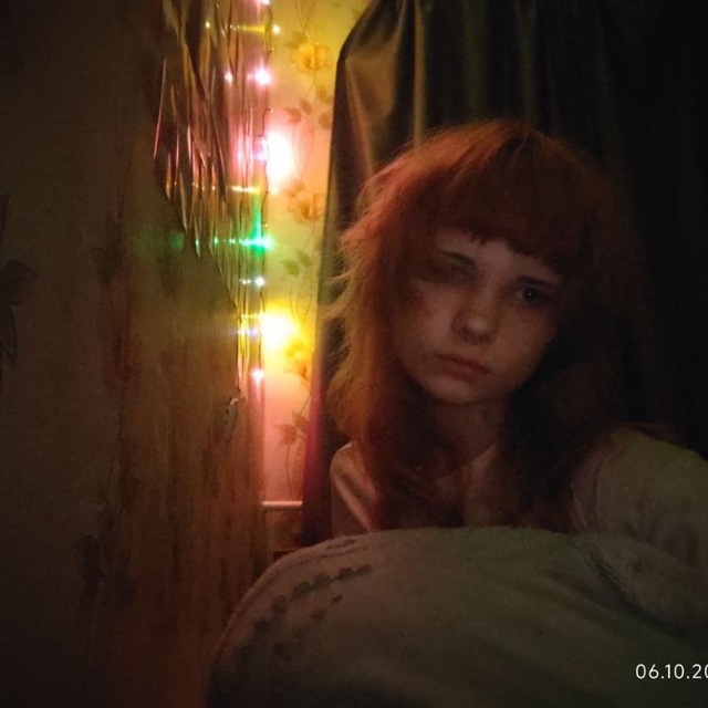 лейк0цитикXD