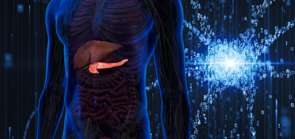 Modelo de Inteligência Artificial pode prever com precisão risco de câncer pancreático, diz estudo (Newsverso/Uesley Durães)