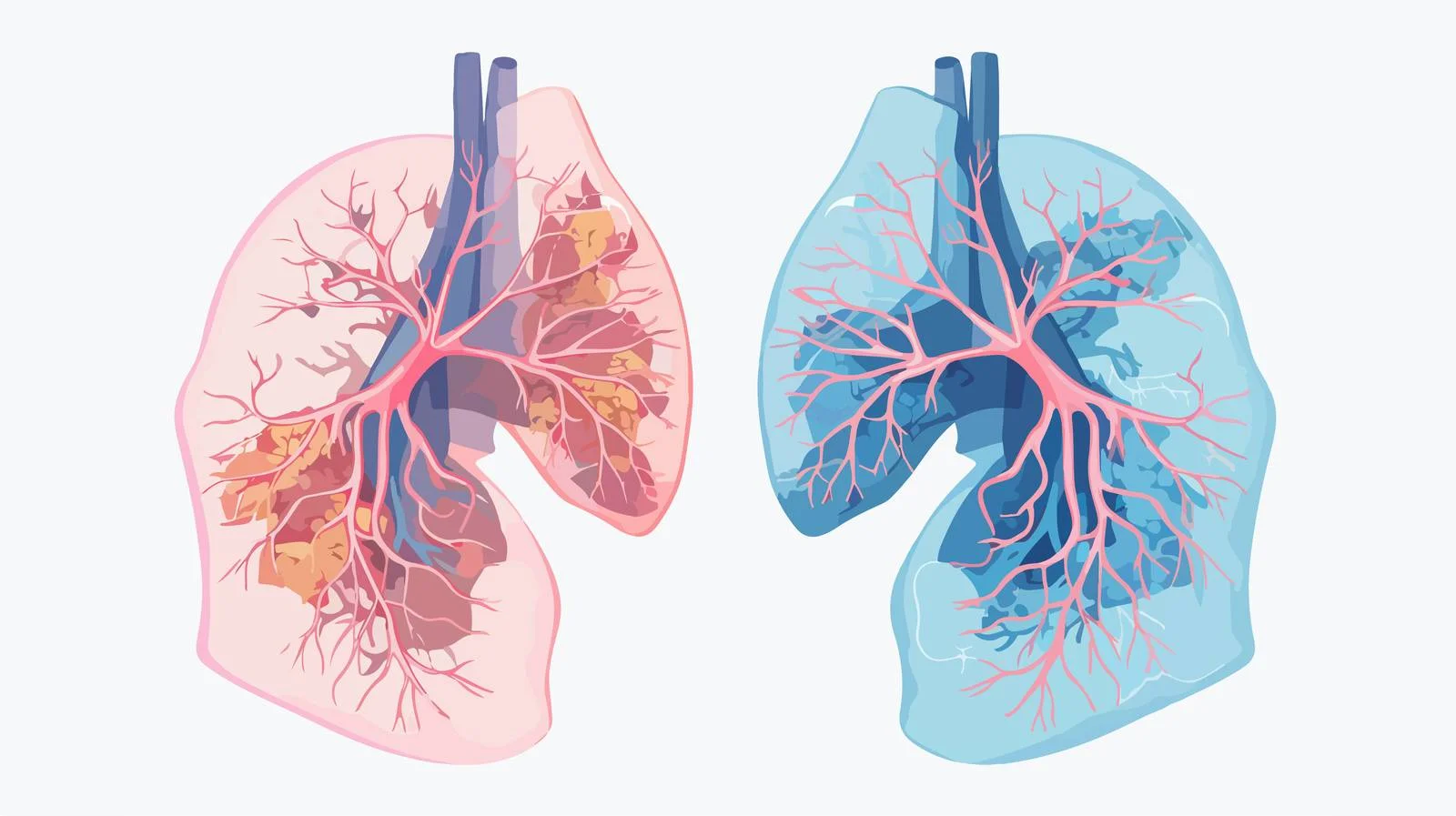 Lung Expansion Contraction Diagram — free download from Dotvec