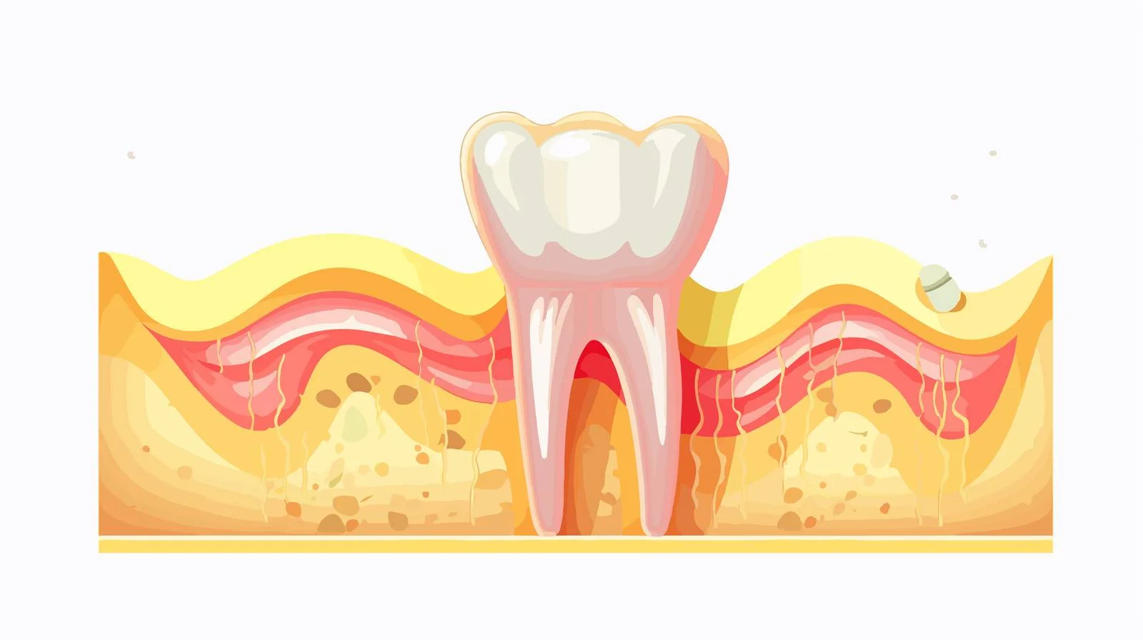 Dental Extraction Procedure — free download from Dotvec