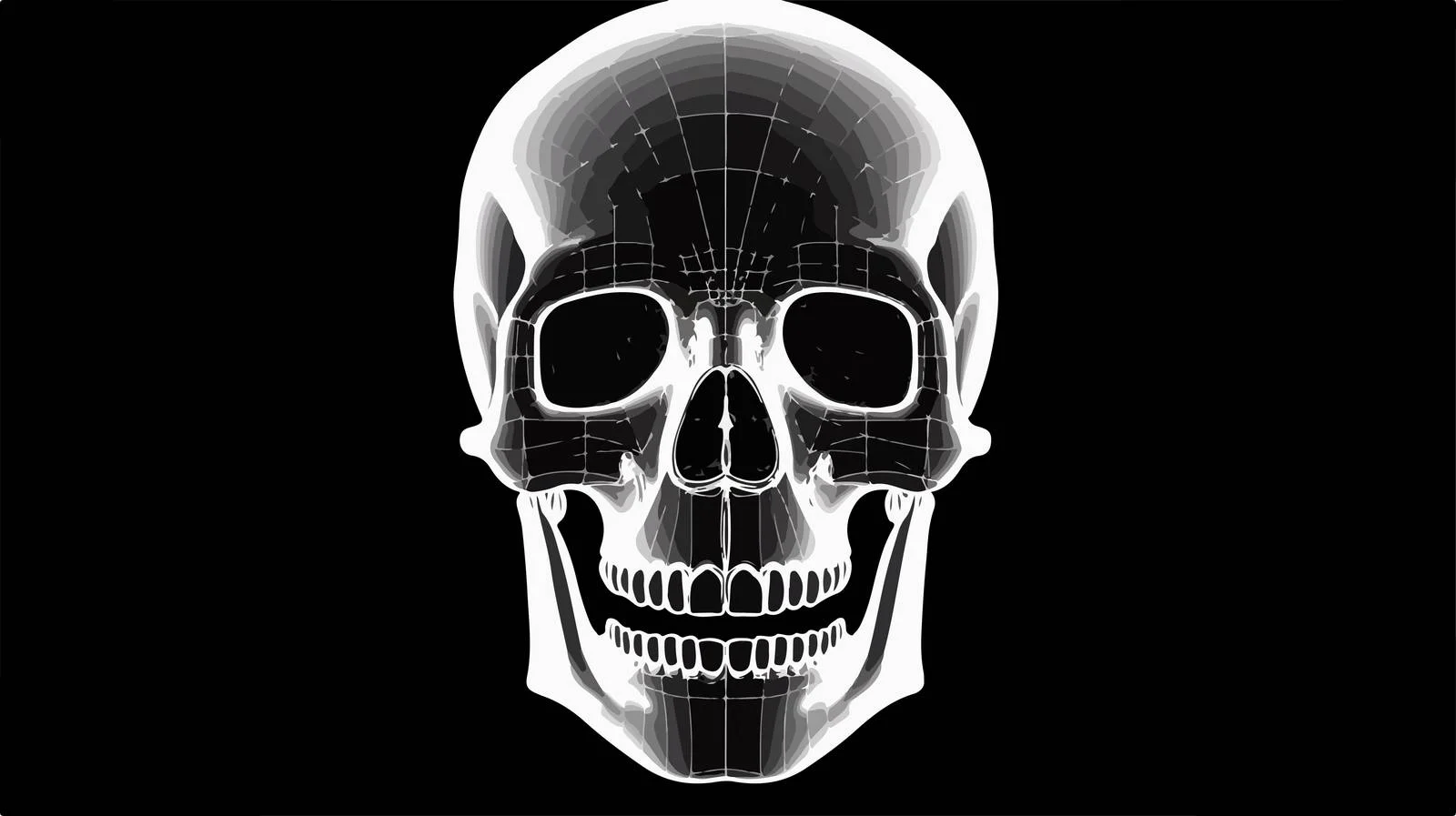 Frontal Skull X-ray Radiograph Analysis — free download from Dotvec