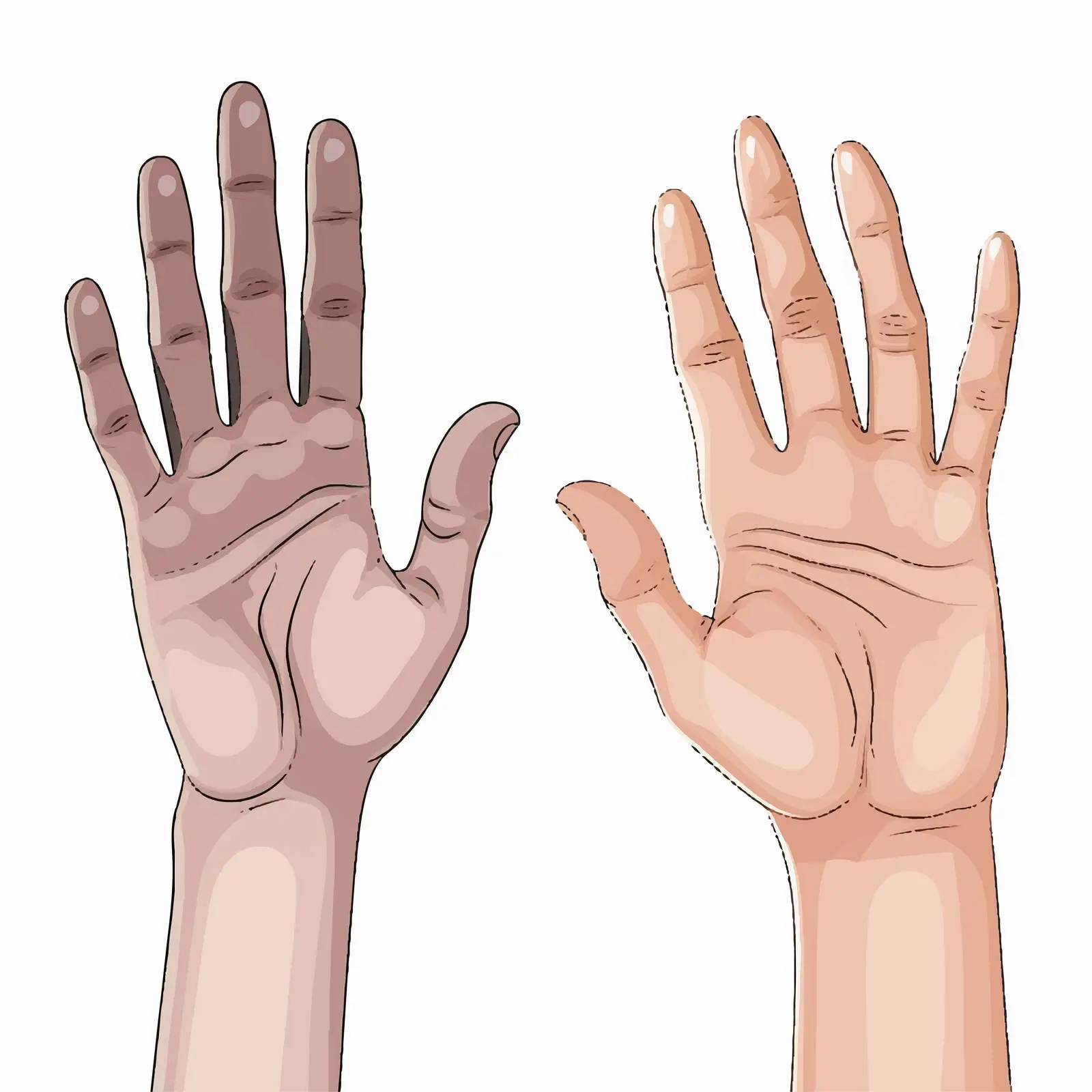 Normal and Affected Hand Comparison Vector – free illustrative comparison image from Dotvec