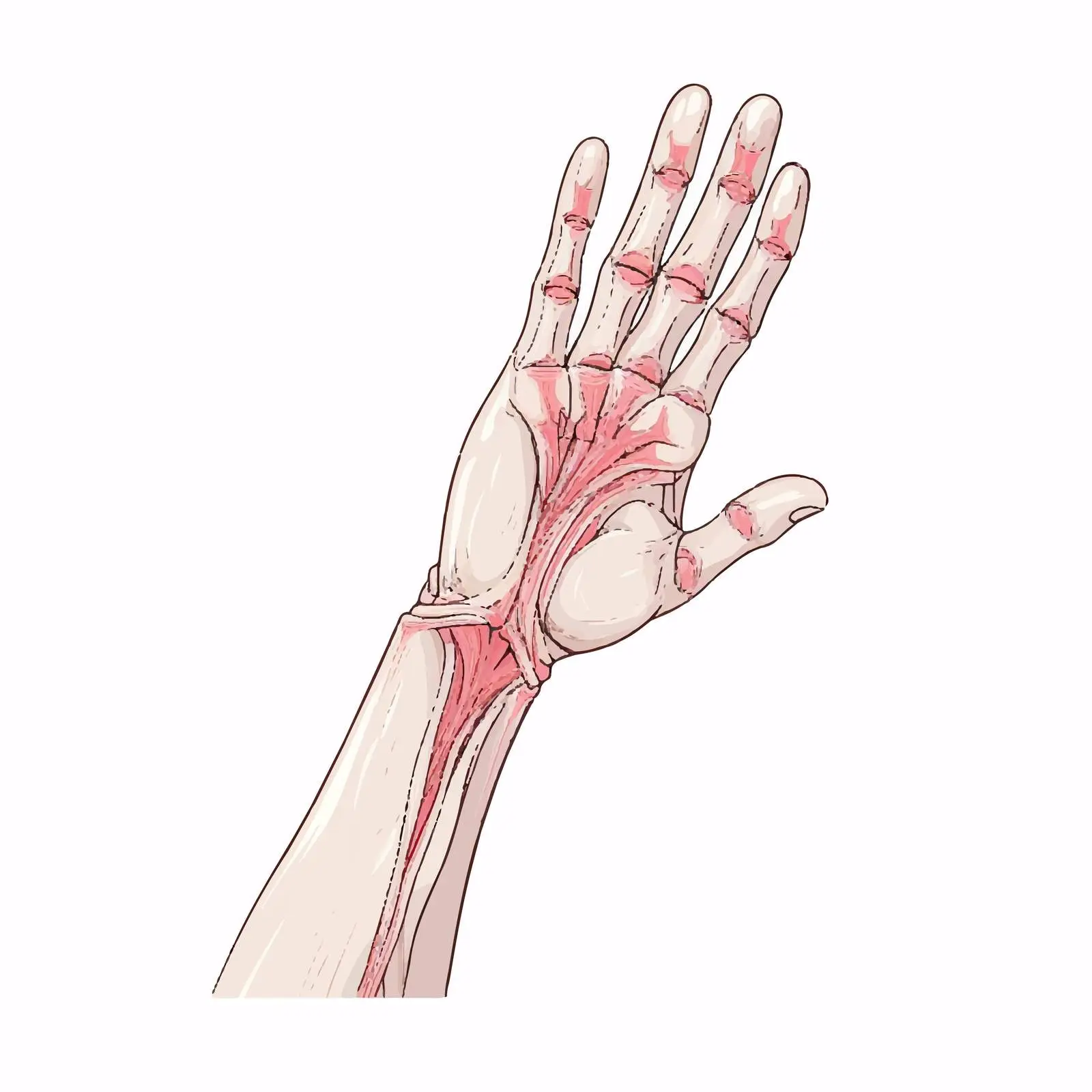Degenerative Joint Disease in Hand and Wrist Vectors — free download from Dotvec