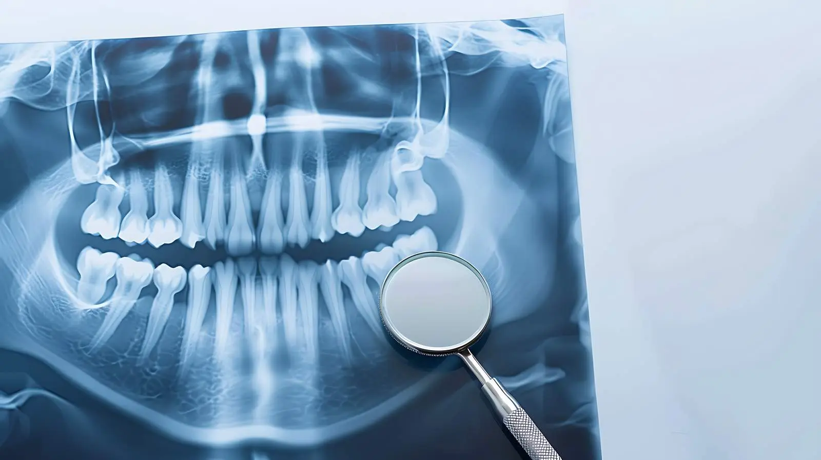 Dental X-ray and Mirror Isolated on White Background – free health services image from Dotvec