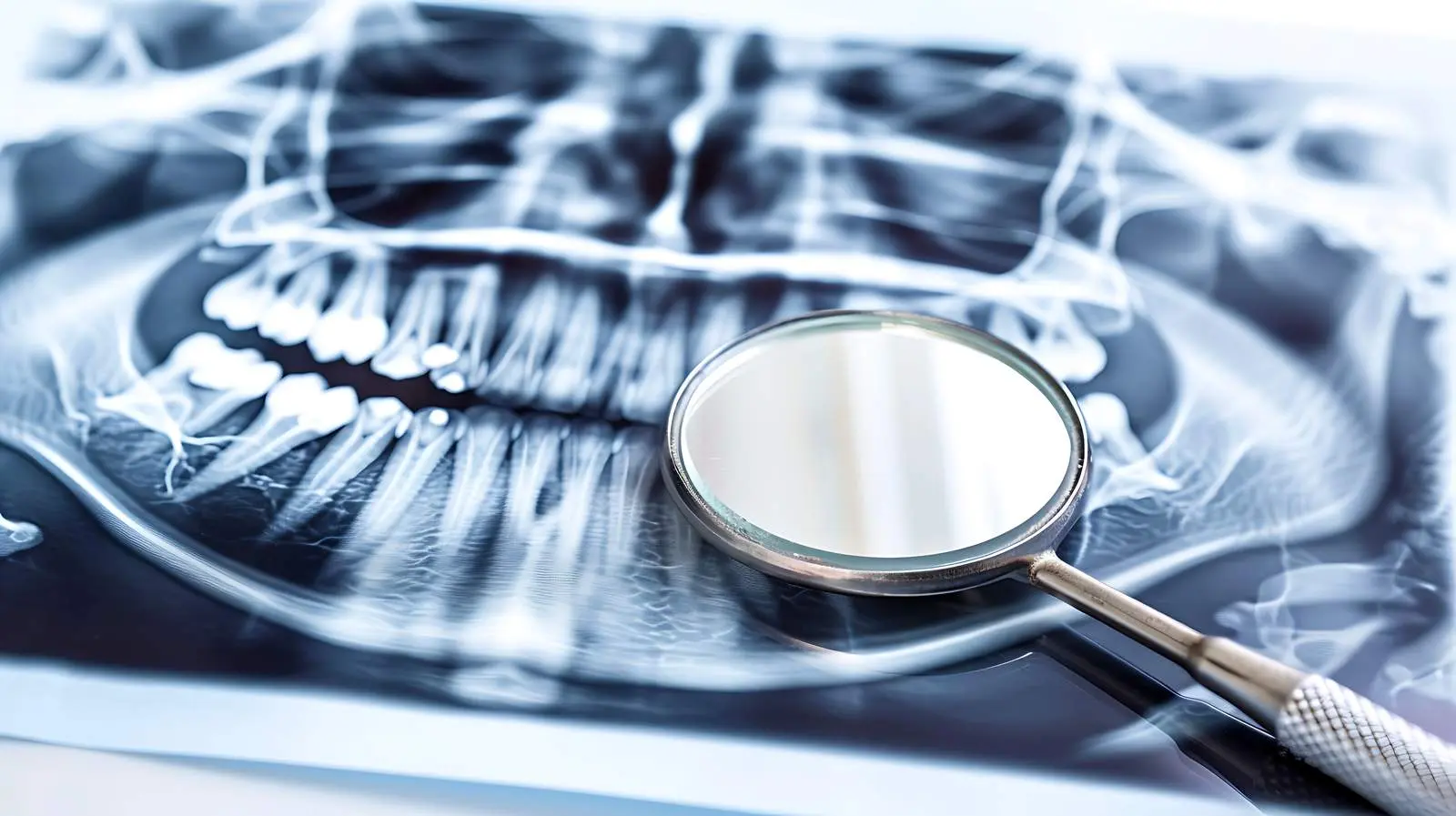 Dental X-Ray and Mirror Isolated on White Background – free health profession image from Dotvec