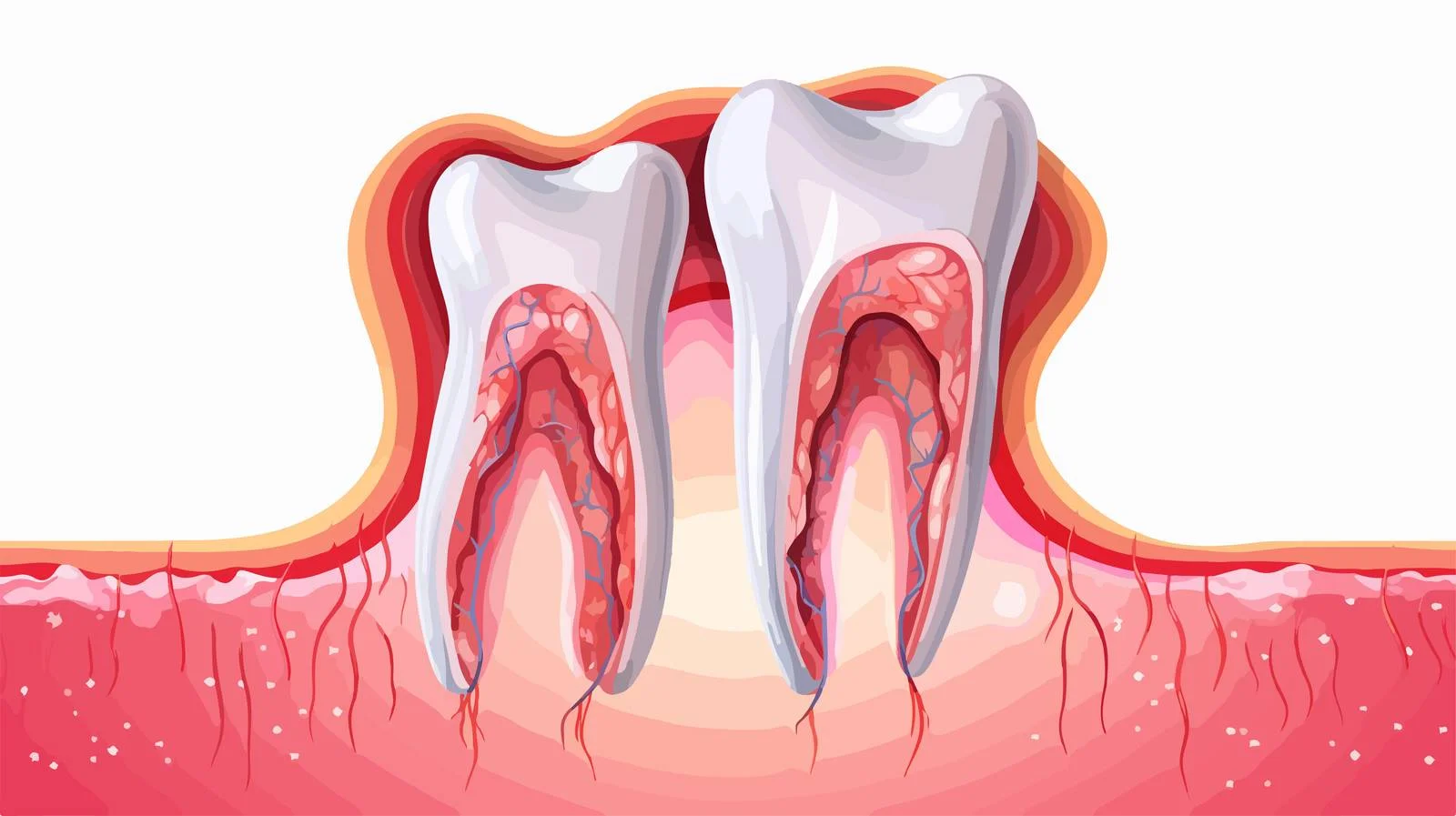 Tooth Decay Prevention — free download from Dotvec