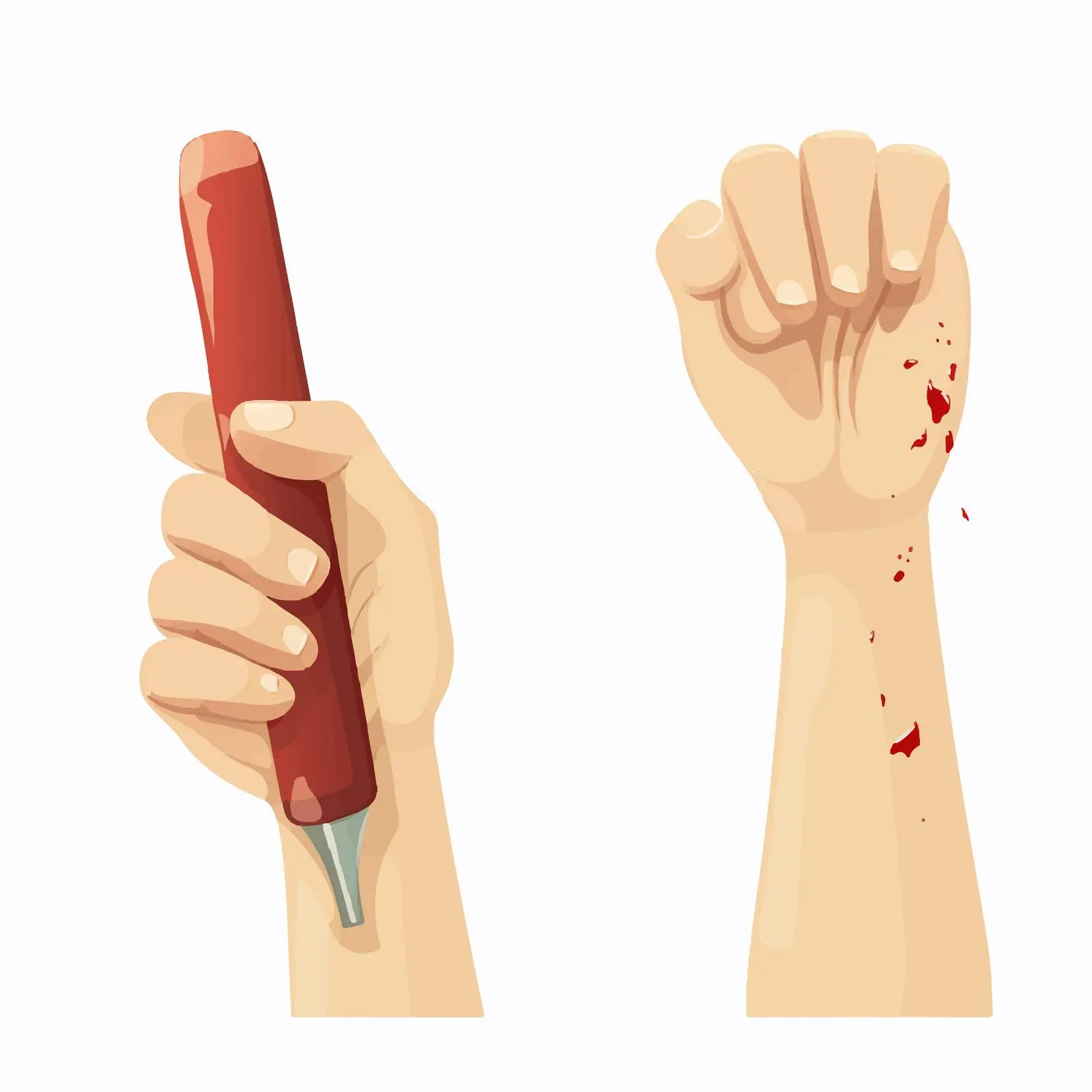 Mallet and Jersey Finger Injuries Diagram – free surgery techniques image from Dotvec