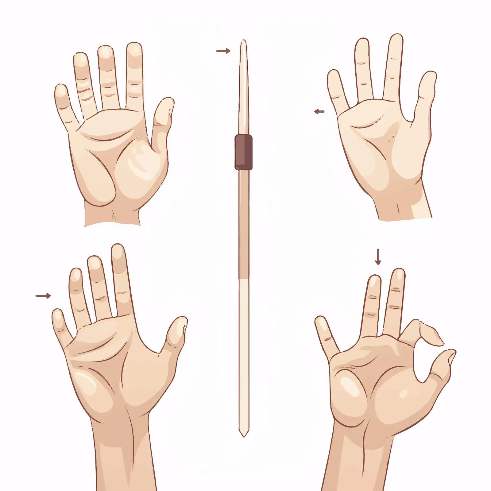 Normal and Mallet Finger Condition Diagram — free download from Dotvec