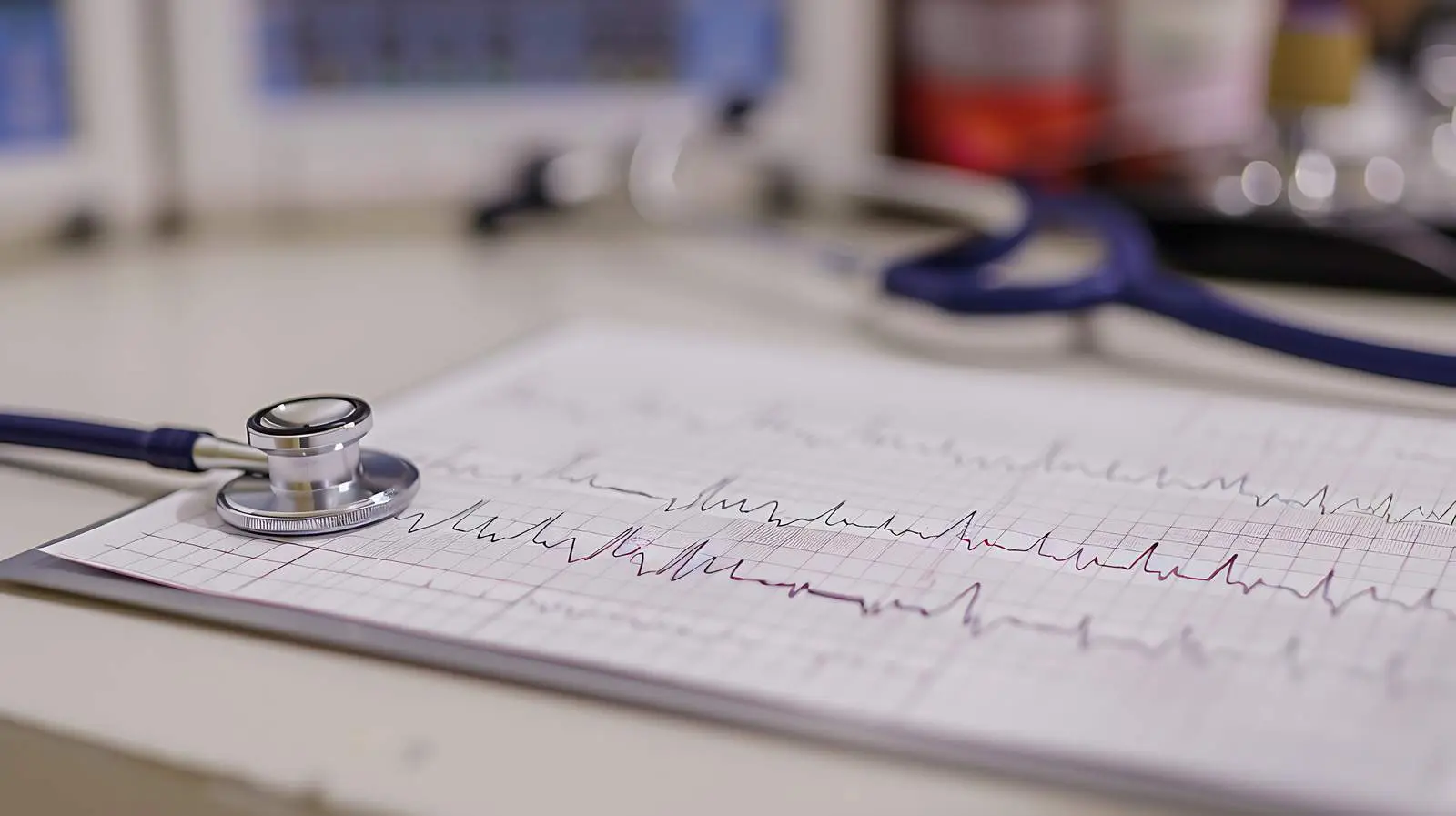 Doctor's Workplace with Stethoscope and Cardiogram Chart – free health services image from Dotvec