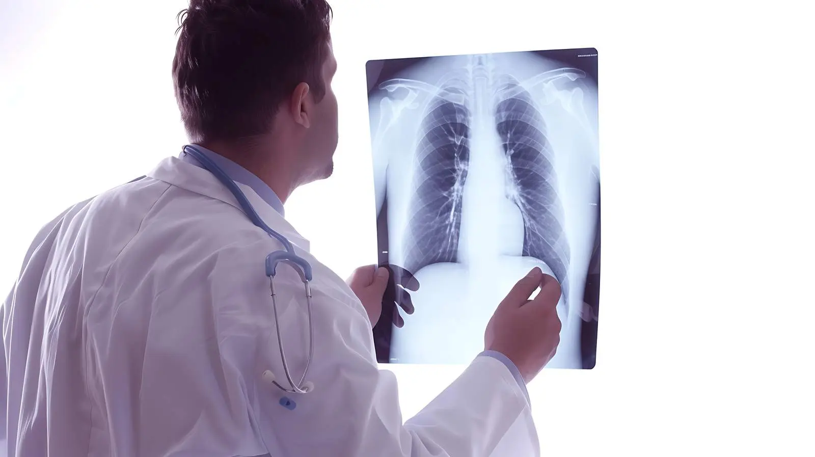 Doctor Reviewing Lung X-Ray Radiography Image – free awareness image from Dotvec