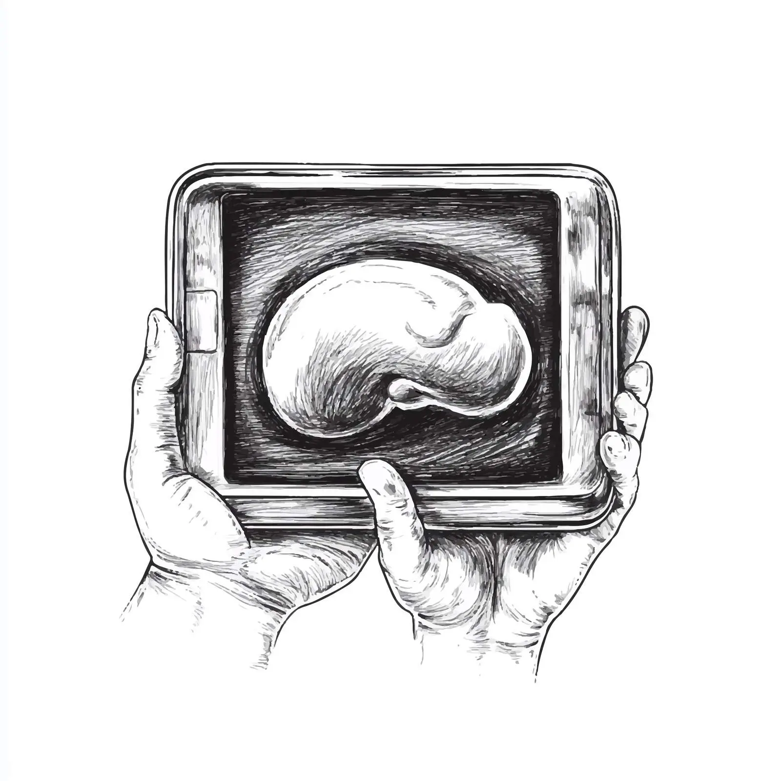 Hand-Drawn Ultrasound Scanner Icon in Hand — free download from Dotvec