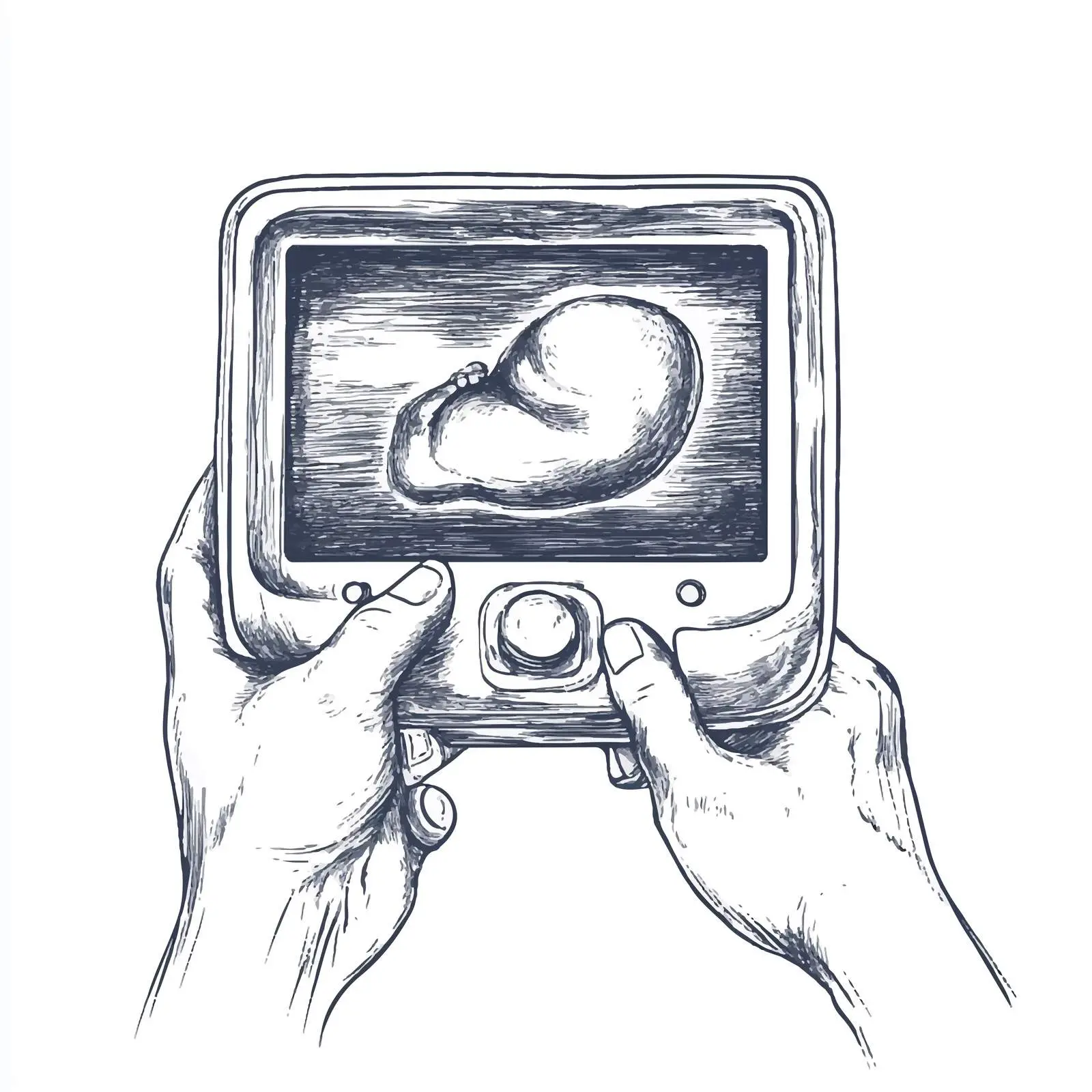 Hand-Drawn Ultrasound Scanner Sketch — free download from Dotvec