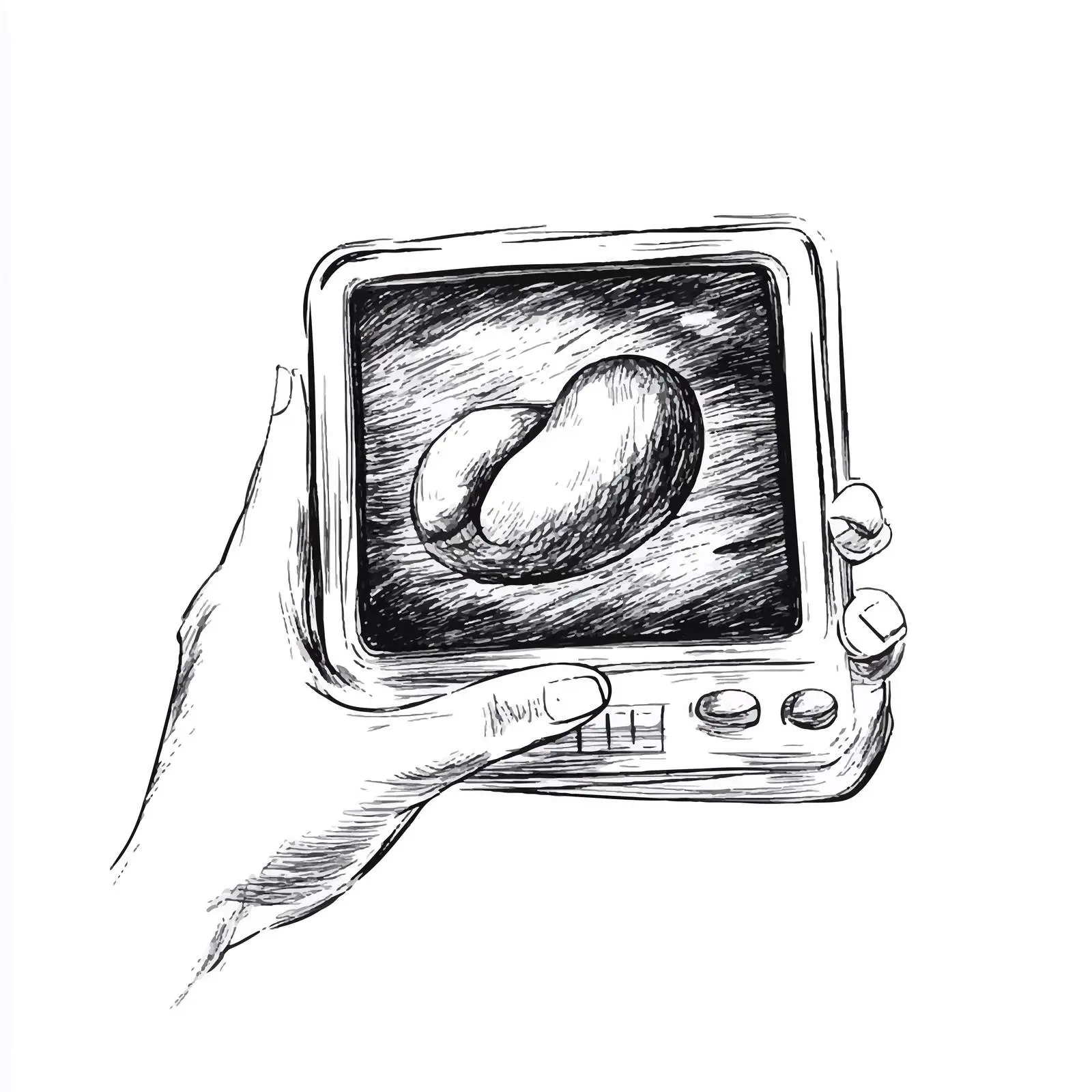 Hand-Drawn Ultrasound Scanner Sketch Illustration — free download from Dotvec