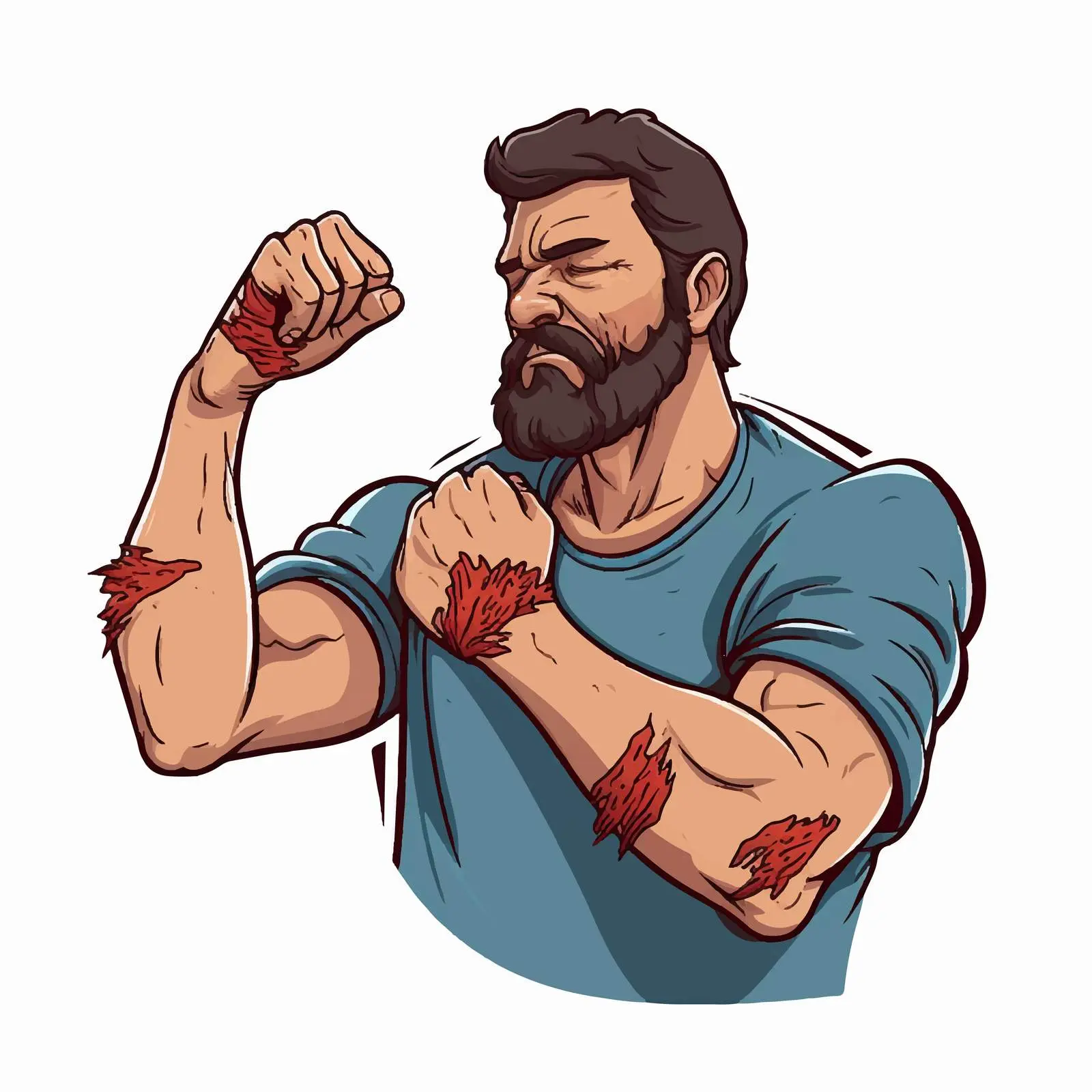 Elbow Bursa Inflammation Vector Illustration – free inflammation image from Dotvec