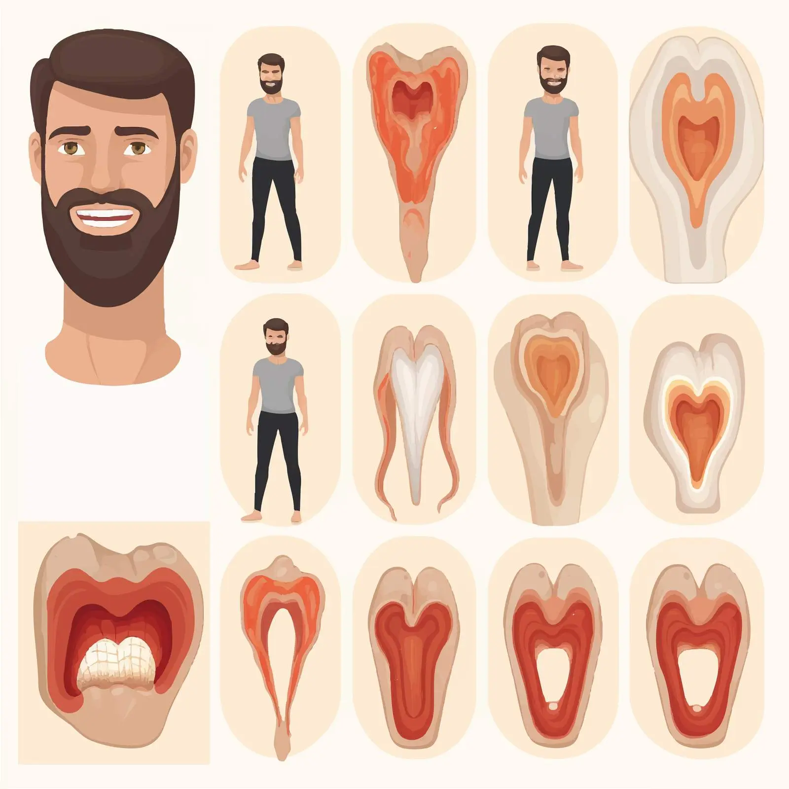 Stages of Dental Caries Development Infographic – free cavity prevention image from Dotvec