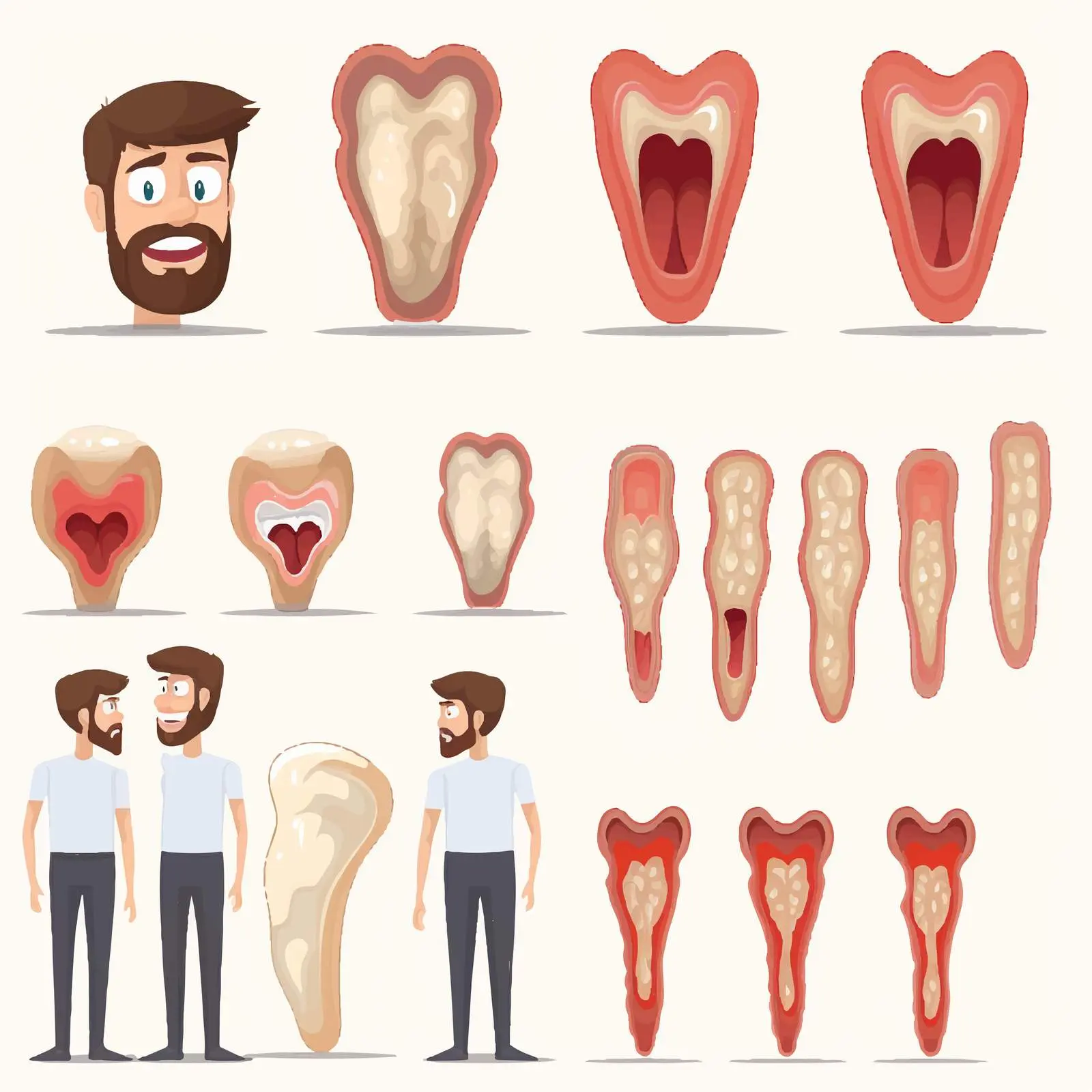 Human Tooth Decay Stages Infographic Illustration — free download from Dotvec