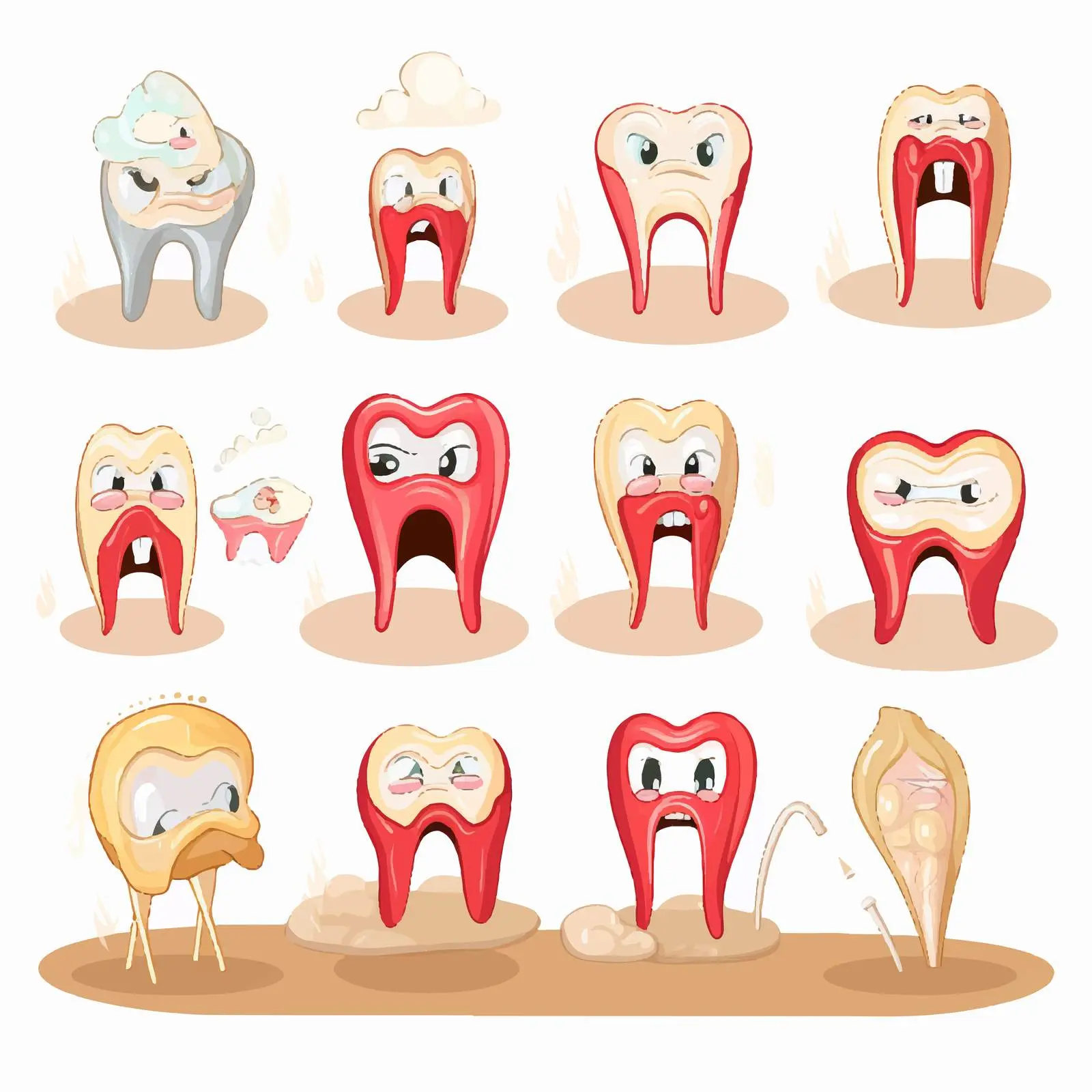 Stages of Tooth Decay Infographic Illustration — free download from Dotvec