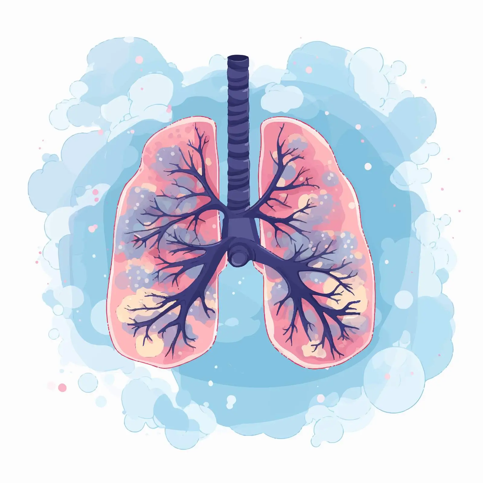 Tuberculosis Infection in Lung Vector Illustration – free microbiology image from Dotvec