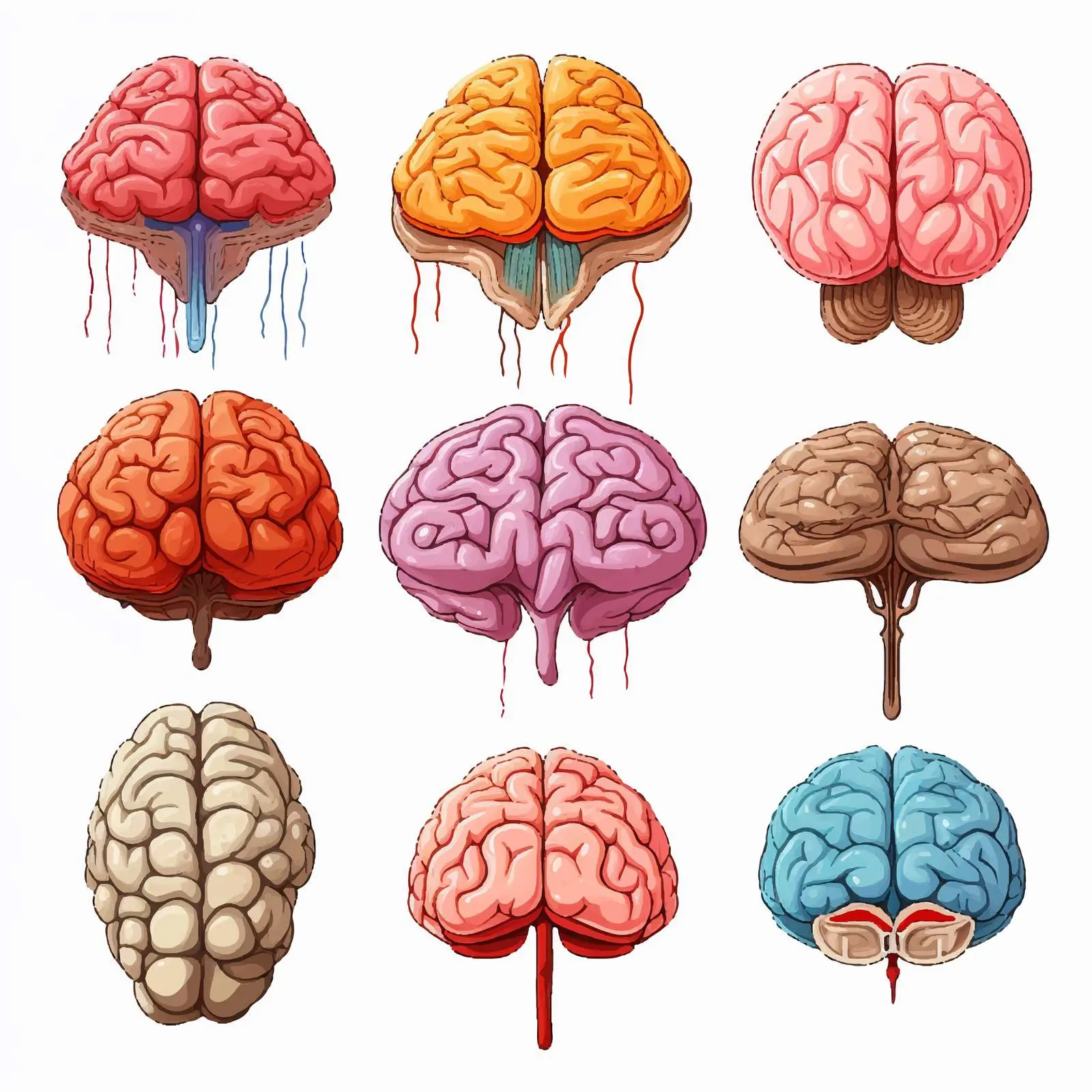 Types of Human Brain Stroke Illustration — free download from Dotvec