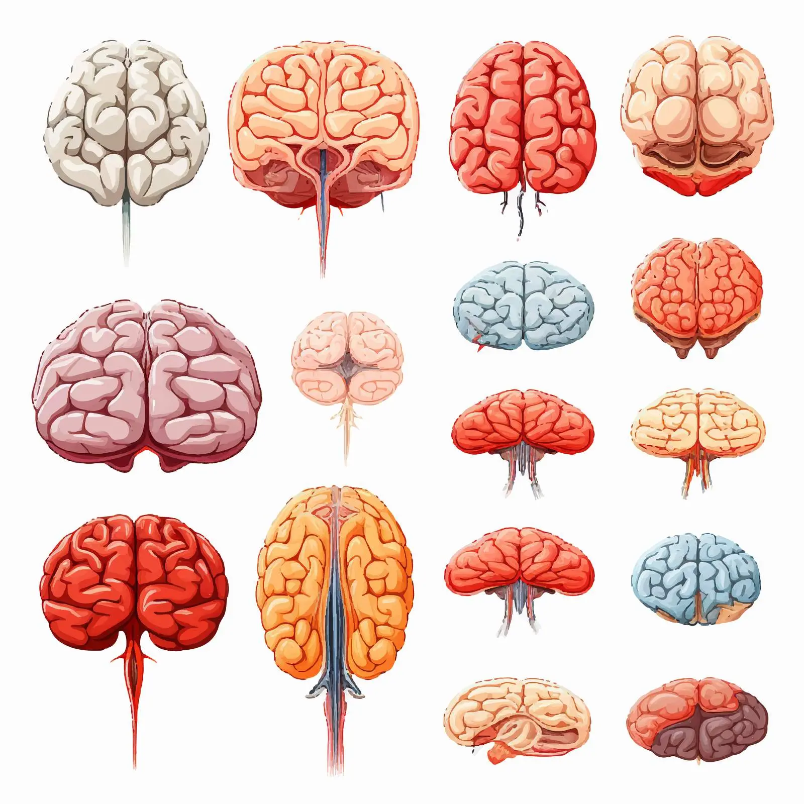 Types of Human Brain Stroke Illustration — free download from Dotvec