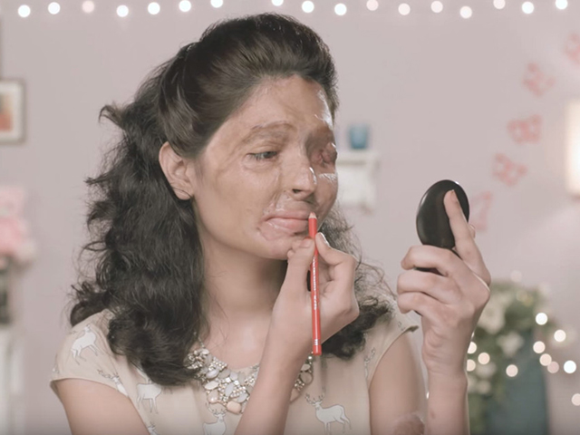 Indiana que teve rosto desfigurado será destaque da semana de moda de NY