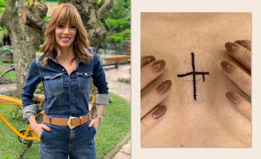 Na reta final de seu tratamento contra o câncer, Ana Furtado diz: “Abençoado seja esse alvo no meu peito”