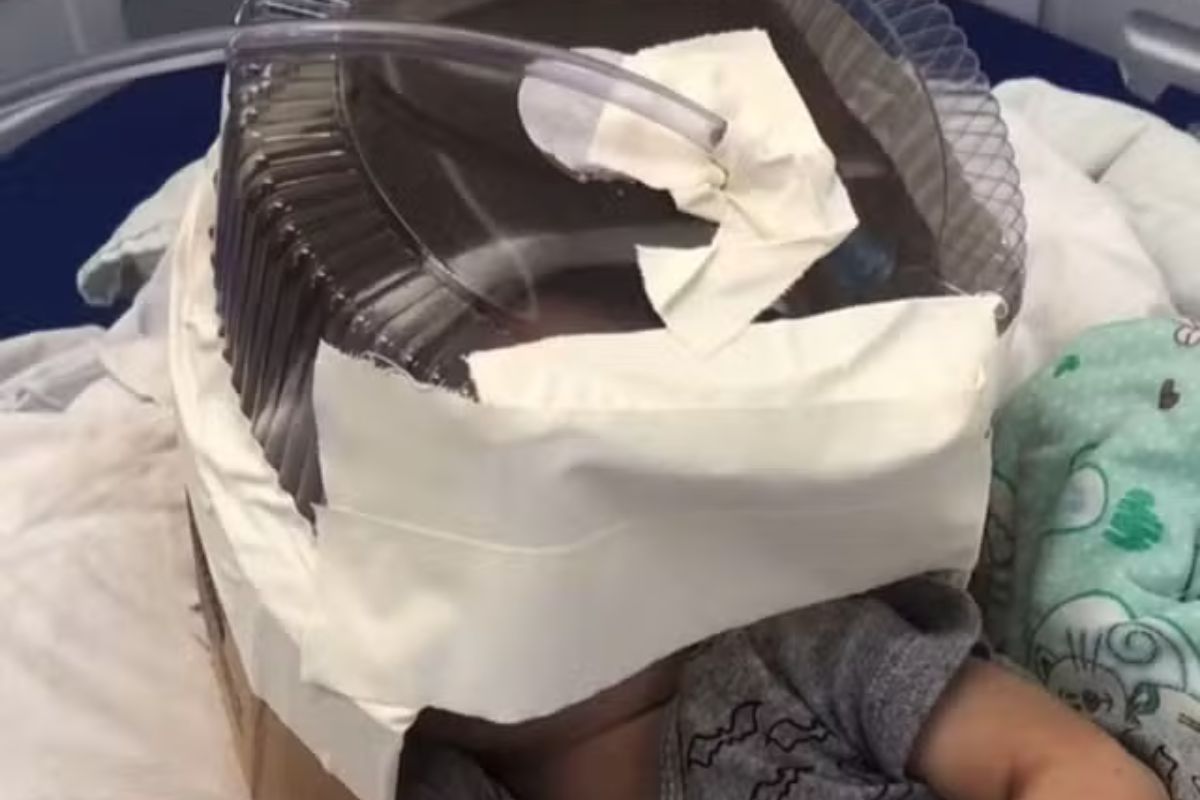Bebê que usou embalagem de bolo improvisada como máscara de oxigênio tem alta