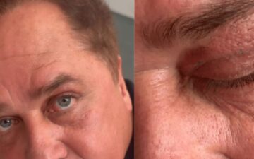 Poliana Rocha mostra resultado de cirurgia estética de Leonardo