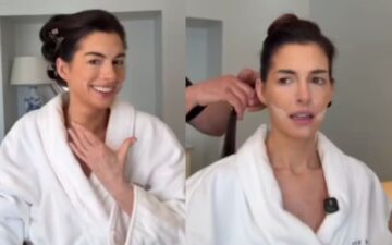 Anne Hathaway revela técnica de beleza usada no Oscar para efeito rejuvenescedor