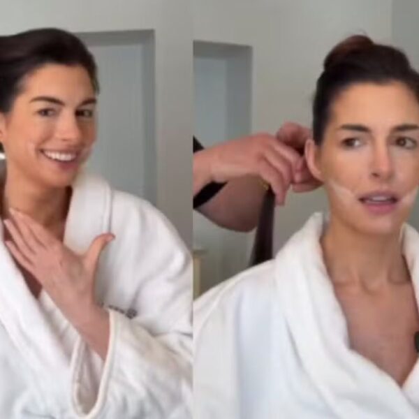 Anne Hathaway revela técnica de beleza usada no Oscar para efeito rejuvenescedor