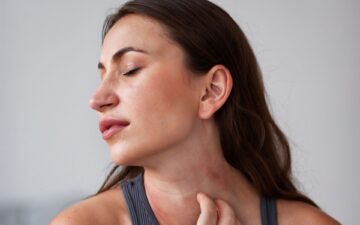 Acne adulta ou rosácea? Entenda as diferenças e por que o diagnóstico correto faz toda a diferença