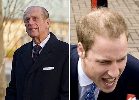 Príncipe William cada vez mais careca