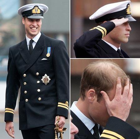 Who knew … One of the most famous bachelor of the world is going bald!