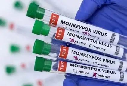 nxnoticias.com-oms-declara-mpox-como-emergencia-mundial-de-salud