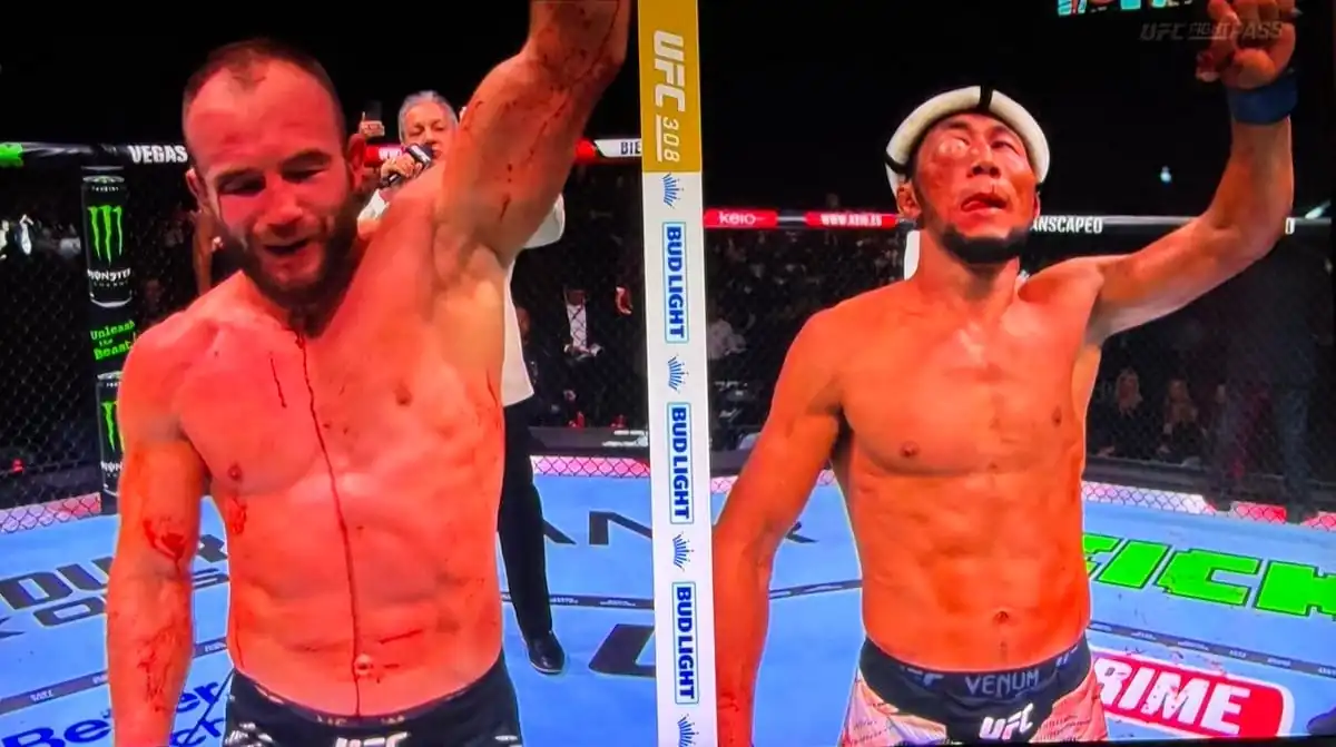 nxnoticias.com-impactante-rostro-de-myktybek-orolba-tras-pelea-con-rebecki-en-ufc-308