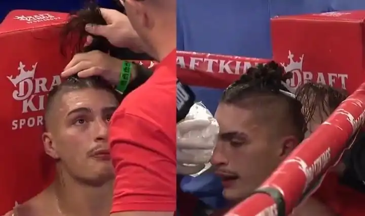 nxnoticias.com-austin-deanda-sorprende-corte-de-pelo-en-plena-pelea-y-victoria