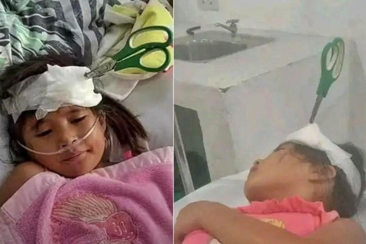 Menina fica com tesoura na cabeça