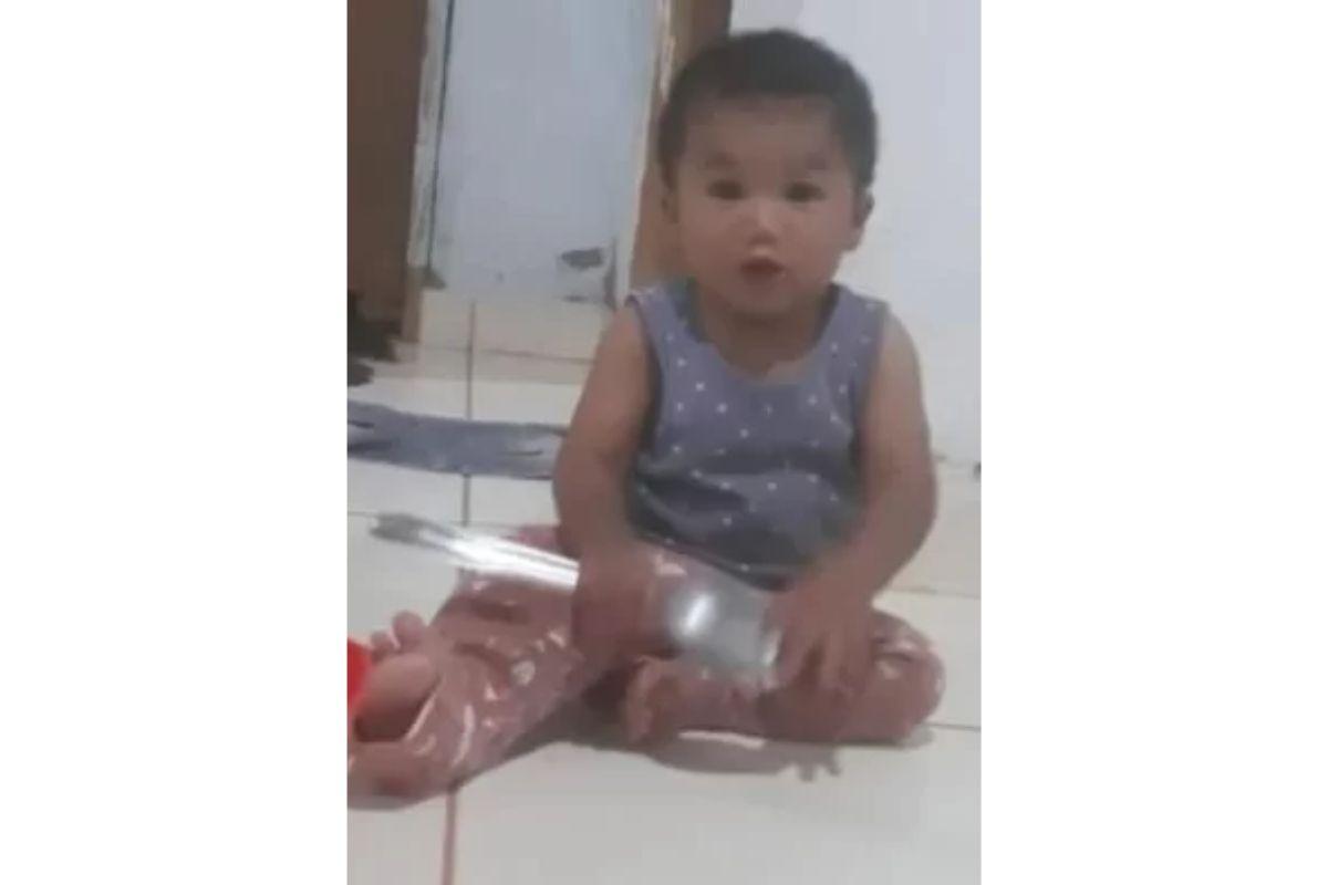 O bebê teve o corpo queimado