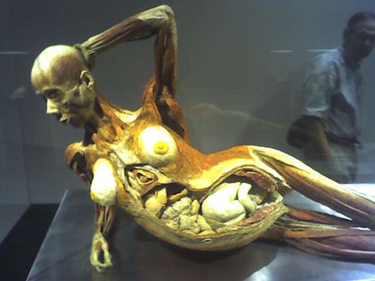 The whole exhibit has a "you know what this is about" air to it, as in, let
the tender viewer beware. But there was a special warning reserved for a
separate chamber wherein reclined this nude woman, who passed away taking
her fetus with her. At
